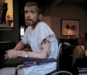 An American AIDS patient